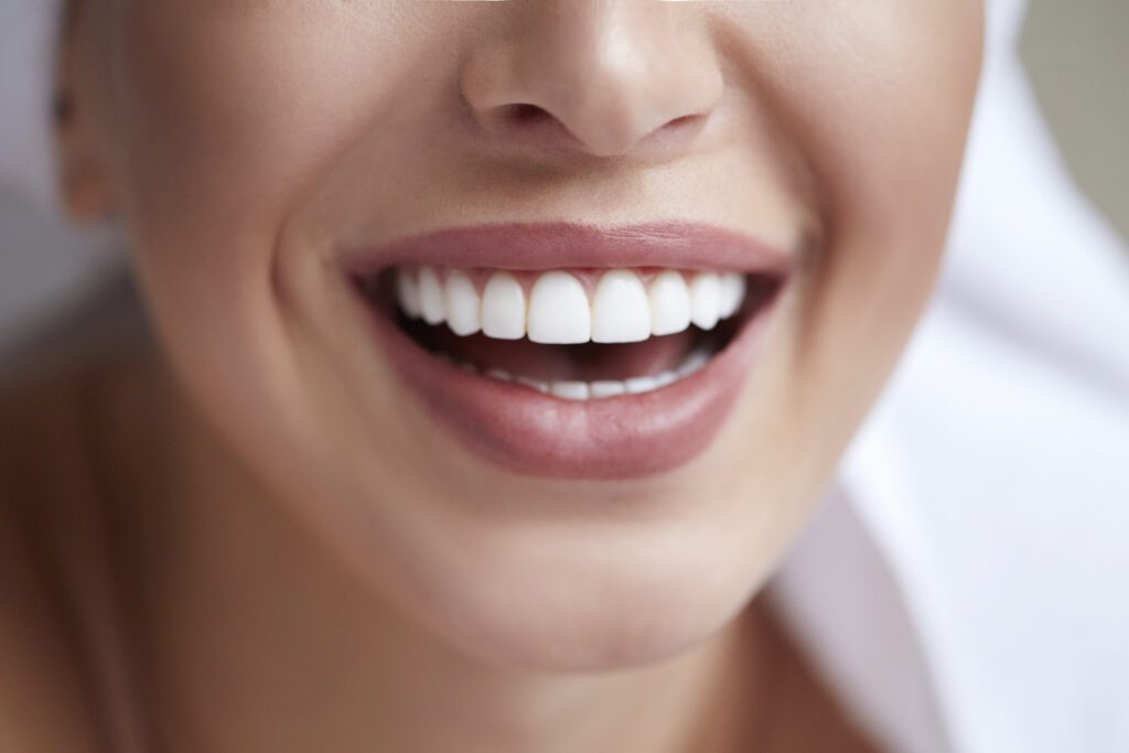 Porcelain Veneers in Plano, TX