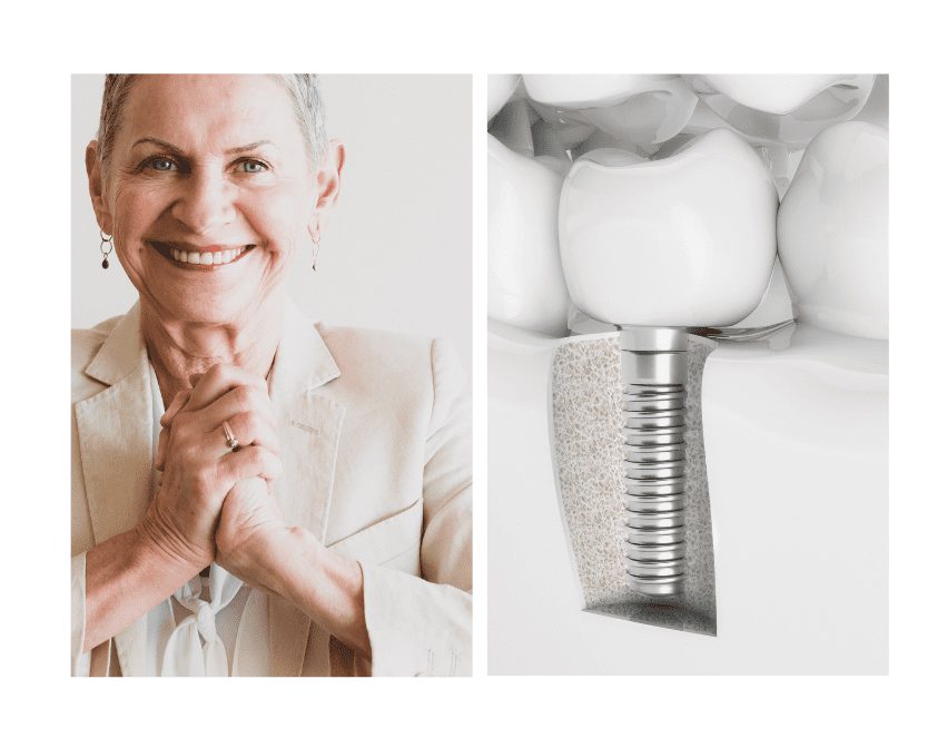 
        Dental implant services in Plano Texas