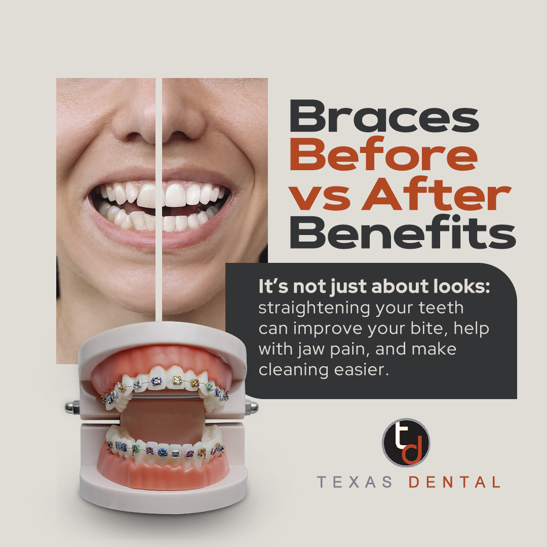 braces before and after